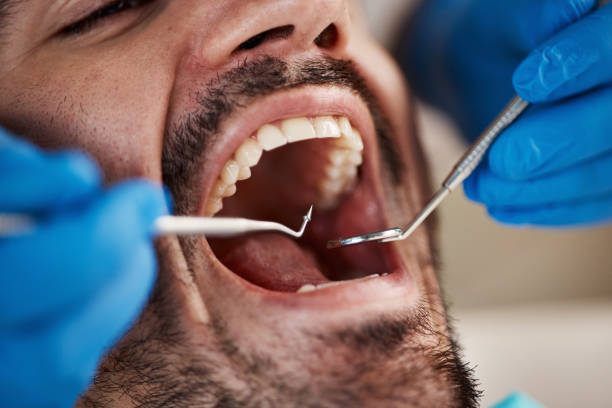 Best Emergency Tooth Extraction  in Osage, IA