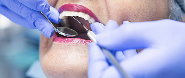 Best Dentist for Tooth Abscess  in Osage, IA